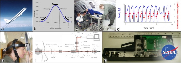 Fabrice Moret Retinal blood flow microgravity astronauts space SANS