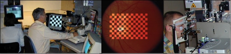 Fabrice Moret visual stimulation flicker neurovascular coupling blood flow